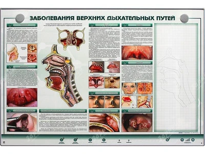 Интерактивный электрифицированный стенд "Заболевания верхних дыхательных путей" с натурными образцами Zarnitza 265555388