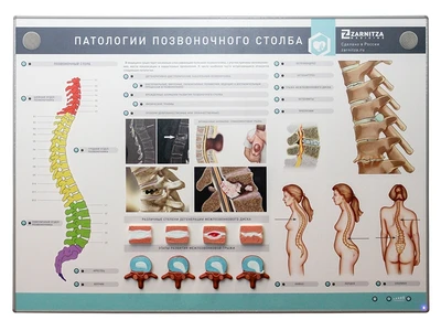 Интерактивный электрифицированный стенд "Патологии позвоночного столба" с натурными образцами Zarnitza 296701545