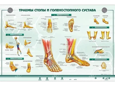 Интерактивный светодинамический стенд "Травмы стопы и голеностопного сустава" Zarnitza 754081004