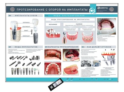 Интерактивный стенд "Протезирование с опорой на имплантаты" Zarnitza 1336741367