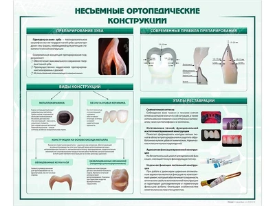 Информационный стенд "Несъёмные ортопедические конструкции" Zarnitza 1734069121