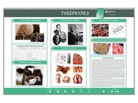 Электрифицированный стенд "Туберкулез" Zarnitza 1523530916