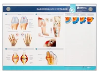 Интерактивный электрифицированный стенд "Заболевания суставов" с натурными образцами Zarnitza 1403472322
