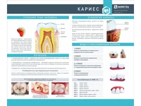 Информационный стенд "Кариес" Zarnitza 318235315