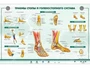 Интерактивный светодинамический стенд "Травмы стопы и голеностопного сустава" Zarnitza 754081004