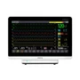 Монитор пациента Mindray BeneVision N15 302630925