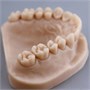 Фотополимерная смола Gorky Liquid Dental Model LCD (1кг) 1984274403